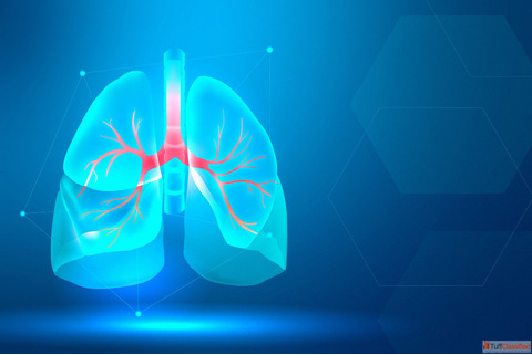 Natural Relief with Homeopathic Treatment for Lung Cancer