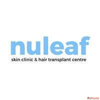 Hair Transplant Cost in Mumbai India - Nuleaf