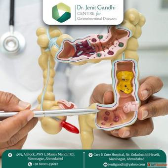 Consult Dr. Jenit Gandhi - Leading Appendix Surgeon in Ahmedabad India Today