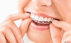 Experience Expert Care at the Best Dental Clinic in Delhi
