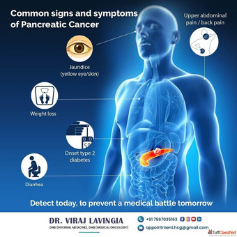 Dr. Viraj Lavingia - Affordable Pancreatic Cancer Treatment in Ahmedabad