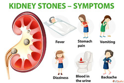 Signs You Need to See a Kidney Stone Specialist