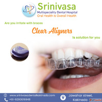Say Goodbye to Braces - Choose Clear Aligners for a Confiden...