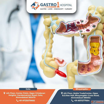 Advanced Care from Top Appendix Doctor in Ahmedabad - Gastro1 Hospital