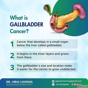 Top Hospital for Gallbladder Cancer Treatment in Ahmedabad