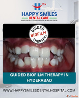 The GBT Protocol - A Professional's Guide to Advanced D...