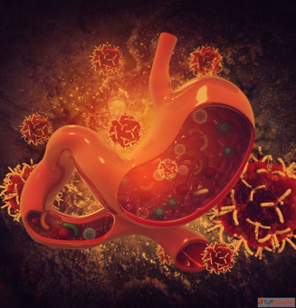 Top Doctor for Stomach Cancer Treatment in Mumbai