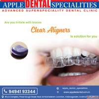 "Say Goodbye to BracesHello to Clear Aligners"