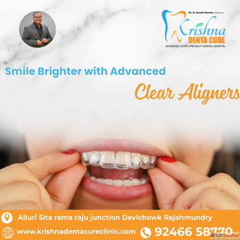 Advanced Clear Aligners in Rajahmundry - Krishna Denta Cure