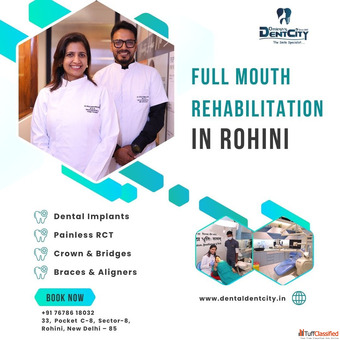 Full Mouth Rehabilitation in Rohini
