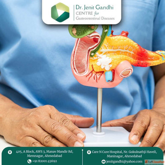 Consult the Best Pancreas Surgeon in Ahmedabad India for Safe Expert Care