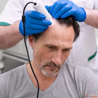 Best Clinic for Hair Fall Treatment in Thane - Safe Trusted Care