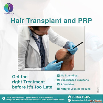 Best Hair Transplant in Ahmedabad with Advanced Techniques