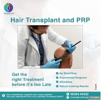 Best Hair Transplant in Ahmedabad with Advanced Techniques