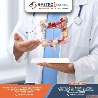 Trusted GI Specialists at the Best Gastroenterology Hospital in Ahmedabad
