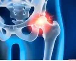 Best Orthopedic Trauma Surgeon in Ahmedabad Elite Hospital