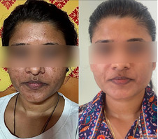 ARNICA - Best Hair Skin Clinic in Pune