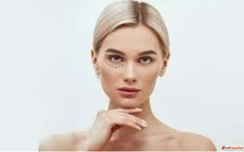 Best Eyelid Surgery Clinic in Gurgaon Upper Lower Blepharoplasty