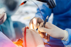 Leading Interventional Radiologist in Mumbai for Advanced Va...