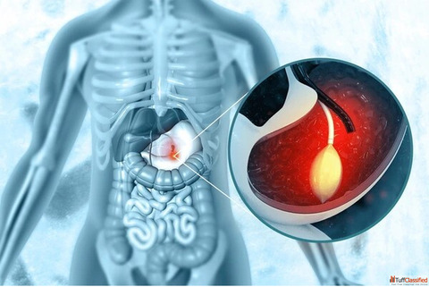 Top Doctor for Endoscopy in Mumbai