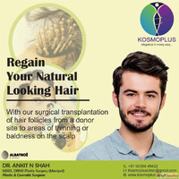 Expert Hair Transplant in Ahmedabad by Skilled Surgeons