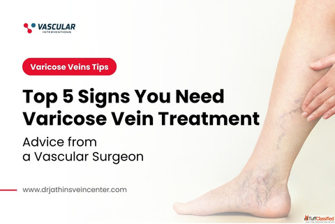 Noticing Leg Discomfort Here's What It May Mean