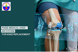 Looking for a Pixee Medical Knee ar system for knee replacem...