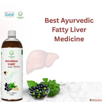 Best Ayurvedic Fatty Liver Medicine