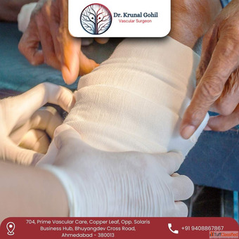 Trusted Vascular Specialist for Best Gangrene Treatment in Ahmedabad India