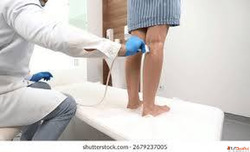 Best Vascular Surgeon in Ahmedabad - Expert Vascular Care by...