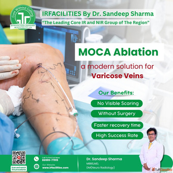 Understanding Varicocele Surgery Cost Key Factors and What to Expect