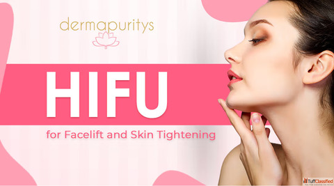 HIFU treatment in Delhi - Dermapuritys