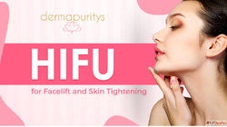 HIFU treatment in Delhi - Dermapuritys