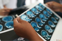 Best Neurosurgeon in Greater Noida Best Neurologist in Great...