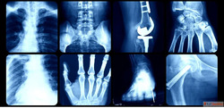 X-ray OPG Near Me - Trusted Digital XRay Centre in South Del...