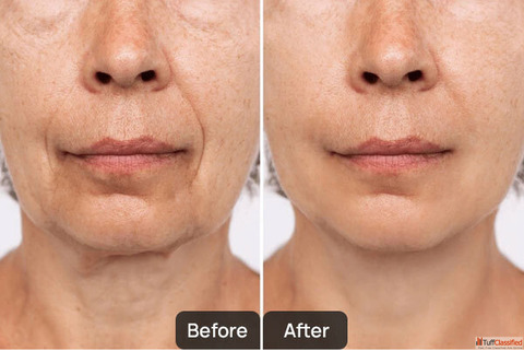 Best Skin Specialist in Chandigarh - Skinology by Dr. Sheenam