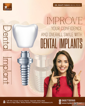 Best Dental Implant Doctor in Indirapuram