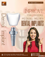 Best Dental Implant Doctor in Indirapuram