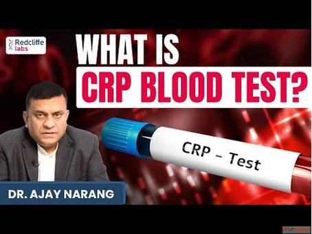 What is CRP Blood Test
