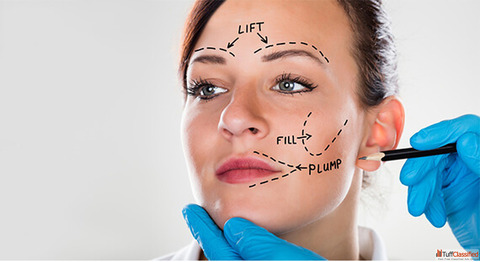 Why I Finally Decided to Get a Facelift and What Surprised Me