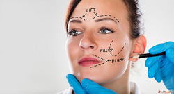 Why I Finally Decided to Get a Facelift and What Surprised M...