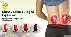 Kidney Failure Stages Explained Symptoms Diagnosis Treatment