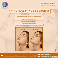 Advanced Rhinoplasty in Ahmedabad with Expert Care at Kosmop...