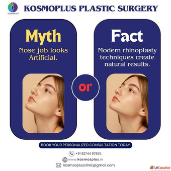 Kosmoplus Trusted Clinic for Rhinoplasty in Ahmedabad