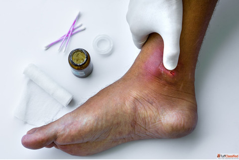 Best Diabetic Foot Surgeon in Mumbai - Dr. Dharav Kheradia