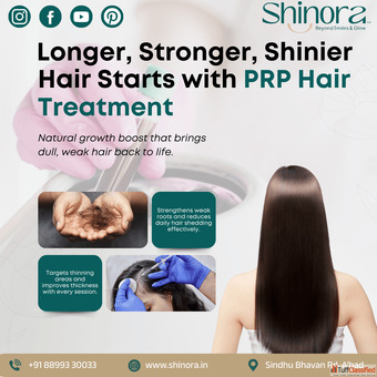 Trusted PRP Hair Treatment Clinic in Ahmedabad - Shinora