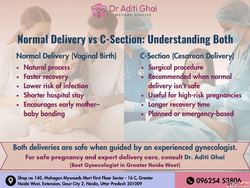 Normal Delivery vs C-Section Expert Guidance from the Best G...