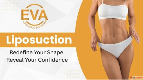 Liposuction Surgery Cost in India What to Know Before You Decide
