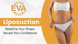 Liposuction Surgery Cost in India What to Know Before You De...