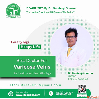 Best Hospital for Varicose Vein Treatment in India - Your Trusted Choice